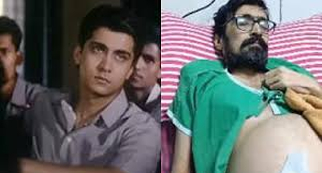 நடிகர் அபிநய் மருத்துவமனையில் அனுமதி