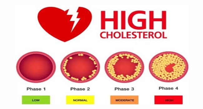இரத்தத்தில் அதிக கொலஸ்ட்ரால் அளவுகள்